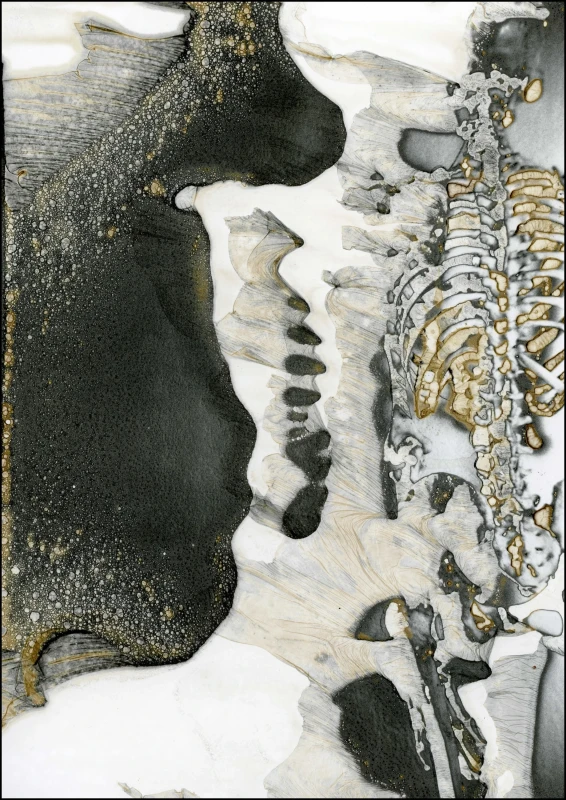 Skeleton